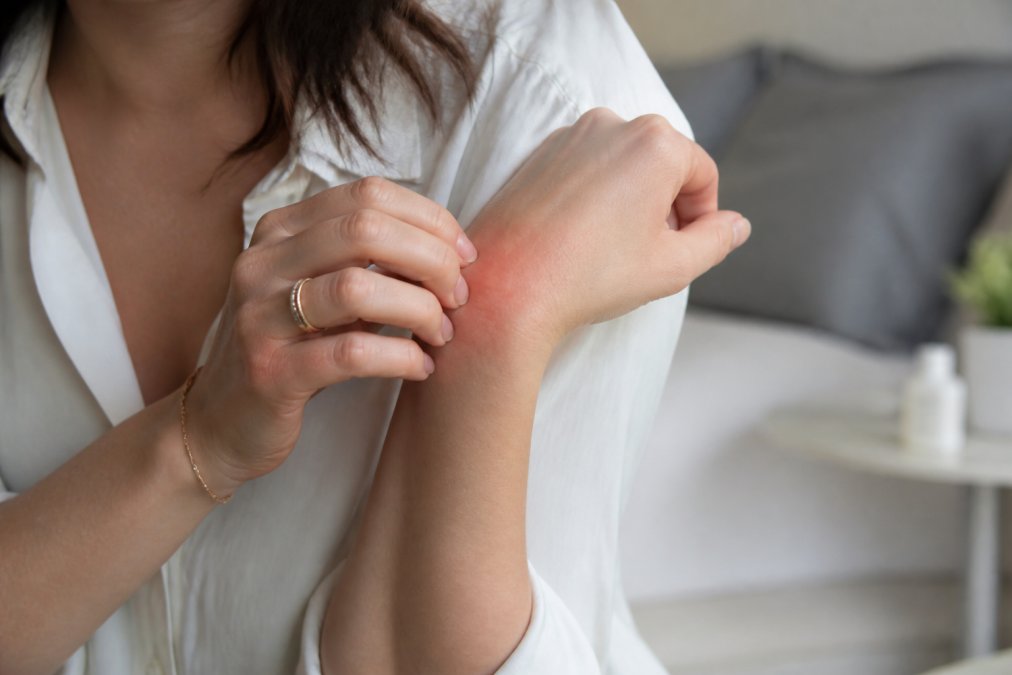 How to Avoid Jewelry Skin Allergies: A 2026 Guide